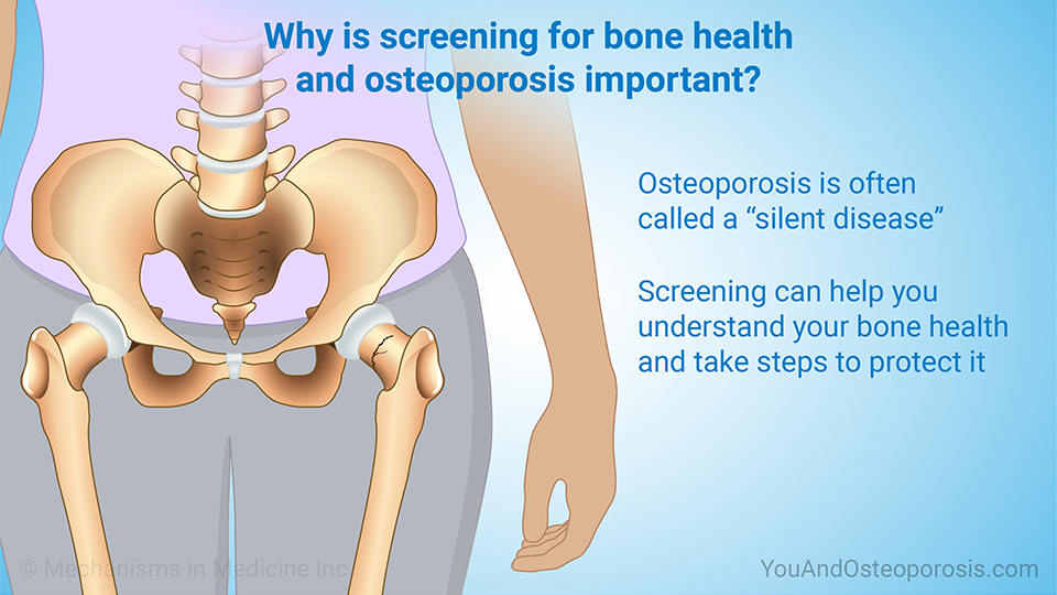 Why is screening for bone health and osteoporosis important? 
