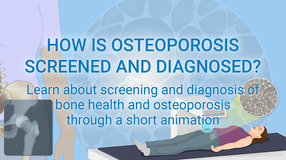 You and Osteoporosis