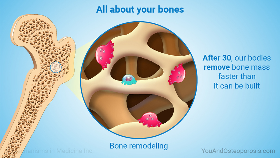 Slide Show - Understanding Bone Health and Osteoporosis