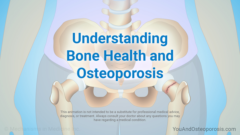 Animation - Understanding Bone Health and Osteoporosis