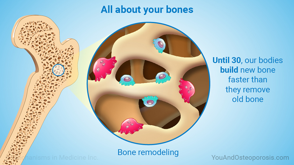 Slide Show - Understanding Bone Health and Osteoporosis