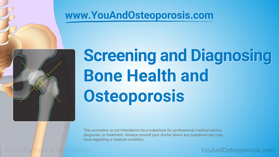 Animation - Screening and Diagnosing Bone Health and Osteoporosis