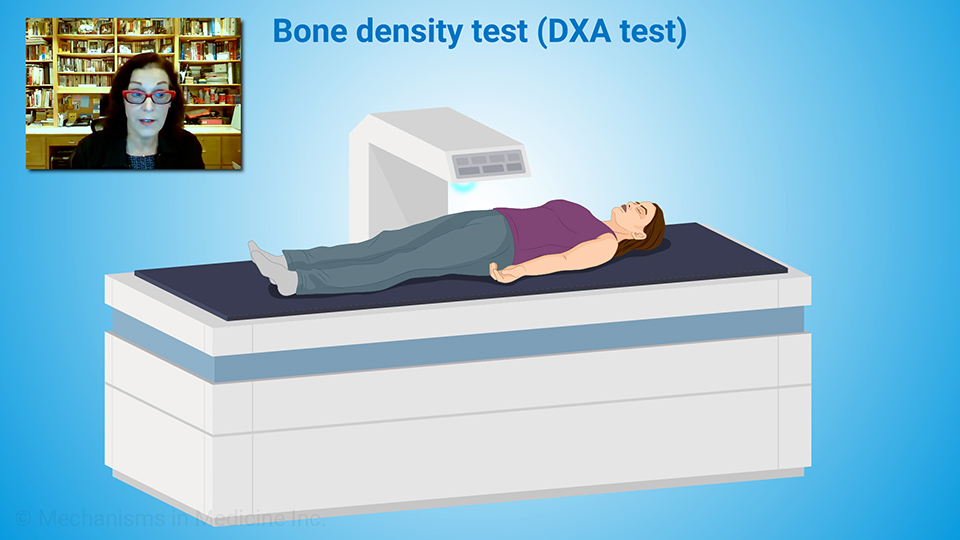 How is osteoporosis screened and diagnosed?