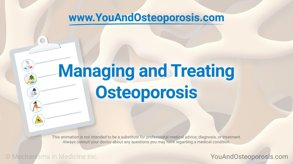 Treating Osteoporosis
