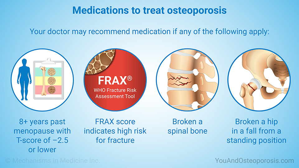 Medications to treat osteoporosis