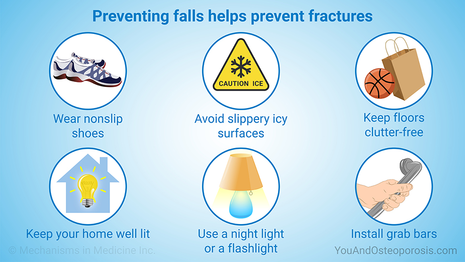Preventing falls helps prevent fractures