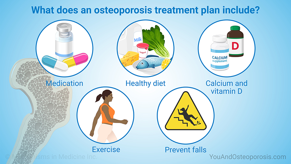 What does an osteoporosis treatment plan include?
