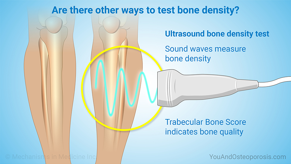 Are there other ways to test bone density?