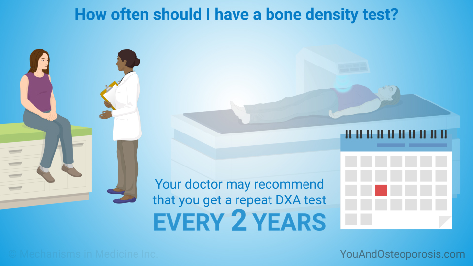 How often should I have a bone density test?