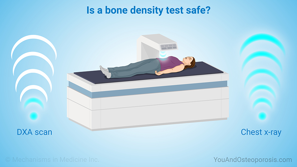 Is a bone density test safe?