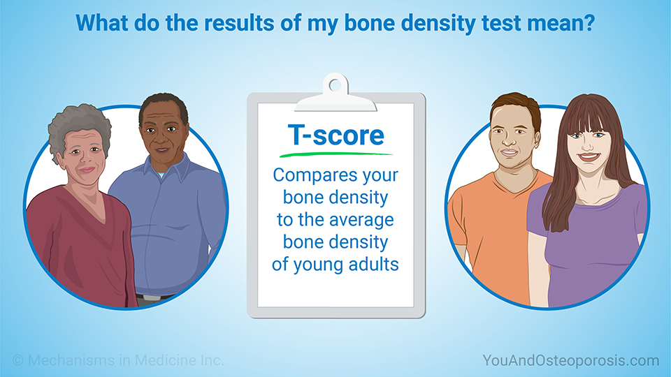 What do the results of my bone density test mean? 