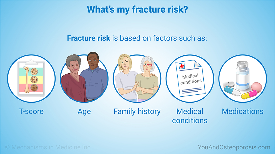 What’s my fracture risk?