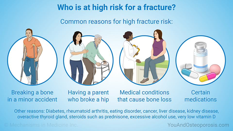 Who is at high risk for a fracture?