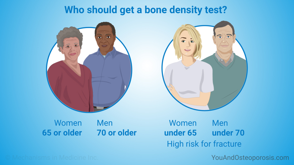 Who should get a bone density test?