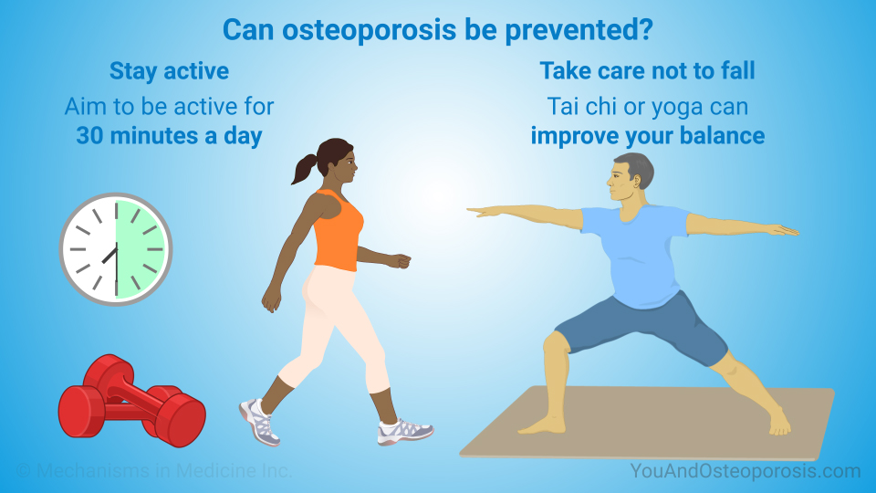 Can osteoporosis be prevented?
