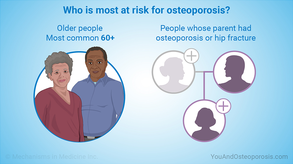 Who is most at risk for osteoporosis?